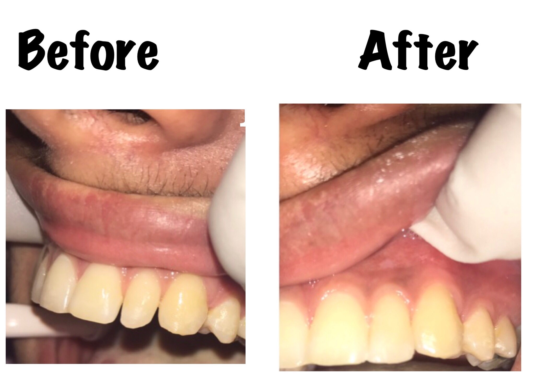 Cosmetic Dentistry